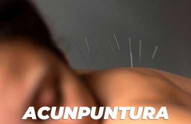 Acupuntura_01